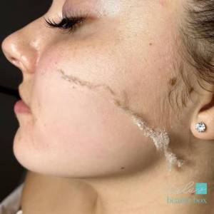 Limpeza De Pele + Dermaplaning