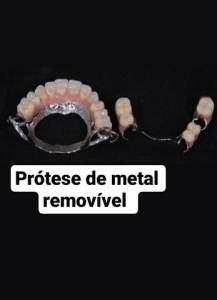 Prtese Dentria A Domiclio A Partir De 200 Reais