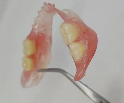 Prtese Dentria