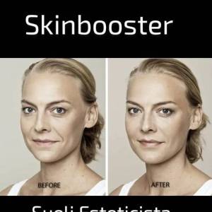 Skinbooster