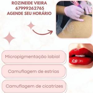 Micropigmentao Labial E Camuflagem De Estrias